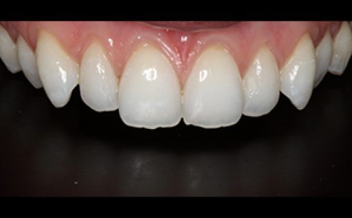 Before - Kreate Dental