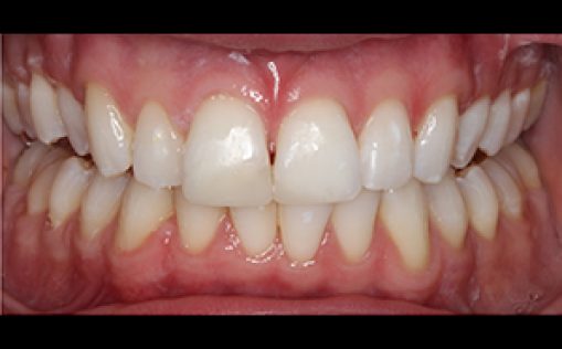 After - Kreate Dental