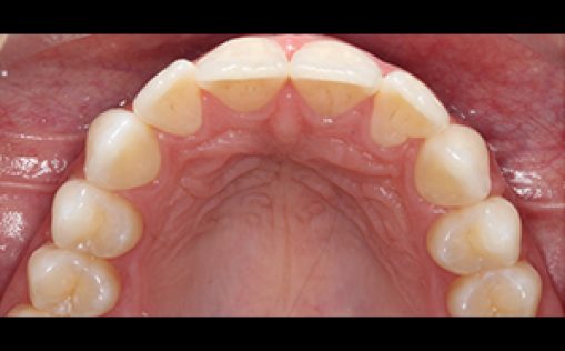 Before - Kreate Dental