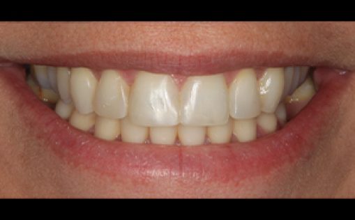 After - Kreate Dental